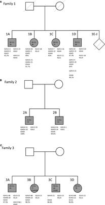 Consistent B Cell Receptor Immunoglobulin Features Between Siblings in Familial Chronic Lymphocytic Leukemia